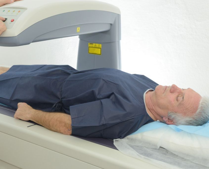 DEXA
